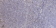 CROT rabbit pAb