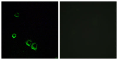AVP Receptor V2 rabbit pAb