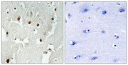 TReP-132 rabbit pAb