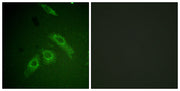 FAK (phospho Ser910) rabbit pAb