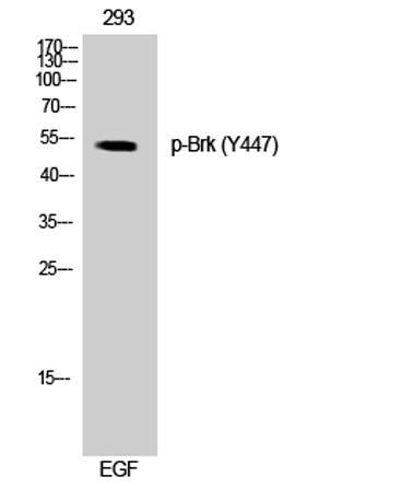 Brk (phospho Tyr447) rabbit pAb