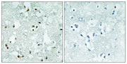 RNase Z2 rabbit pAb