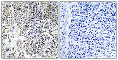 p47-phox (phospho Ser304) rabbit pAb
