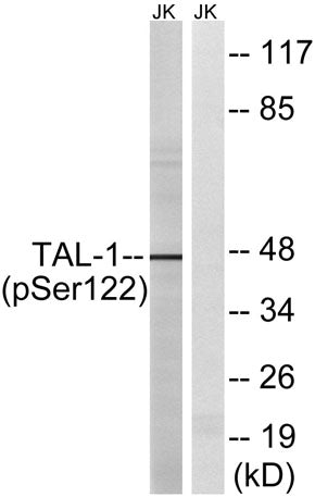 TAL1 (phospho Ser122) rabbit pAb