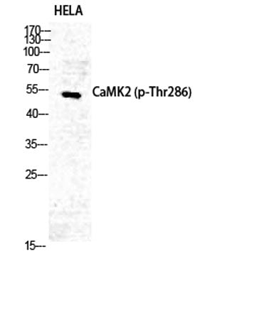 CaMKIIα/δ (phospho Thr286) rabbit pAb
