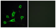 CRBP-III rabbit pAb