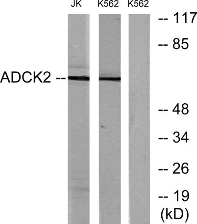 ADCK2 rabbit pAb