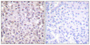 N-CoR rabbit pAb