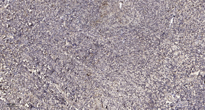 ACAP1 (phospho Ser554) rabbit pAb