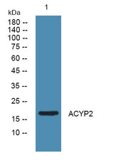 ACYP2 rabbit pAb