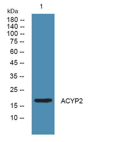 ACYP2 rabbit pAb