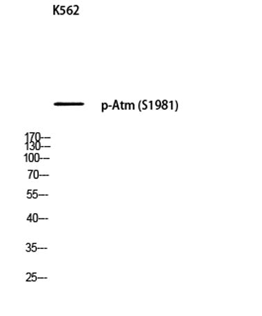 Atm (phospho Ser1981) rabbit pAb