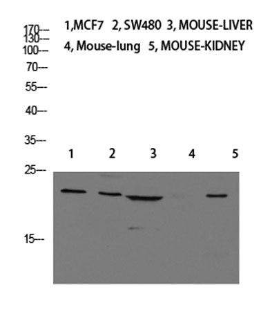 Calcitonin rabbit pAb