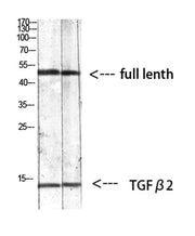 TGFβ2 rabbit pAb