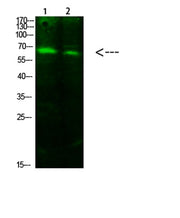 ACSS1 (Acetyl-K642) rabbit pAb