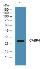 CABP4 rabbit pAb
