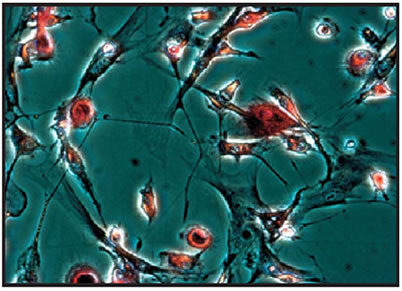 Tartrate-resistant acid phosphatase (TRACP) and alkaline phosphatase (ALP) detection - Antibodies and ELISA - Takara Bio