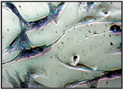 Tartrate-resistant acid phosphatase (TRACP) and alkaline phosphatase (ALP) detection - Antibodies and ELISA - Takara Bio