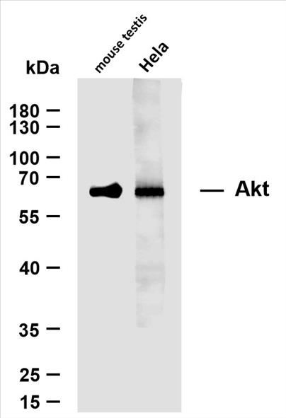 Various whole cell lysates were separated by 10% SDS-PAGE, and the membrane was blotted with anti-AKT (PT0013R) antibody. The HRP-conjugated Goat anti-Rabbit IgG(H + L) antibody was used to detect the antibody.