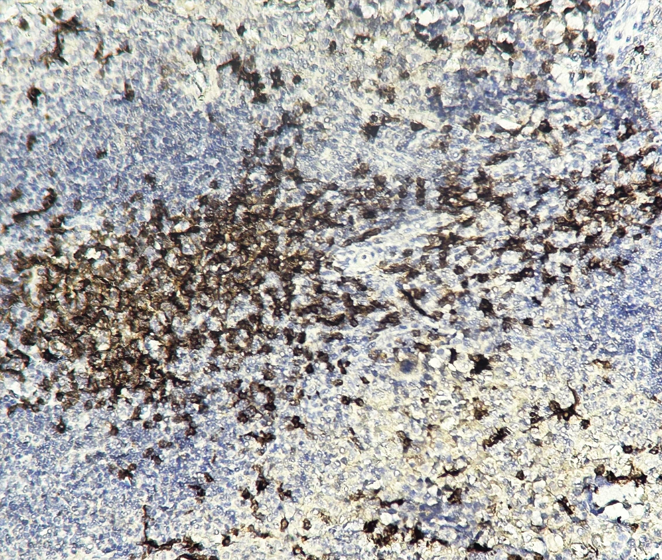 Mouse spleen tissue was stained with anti-CD8 a (PT0023R) rabbit Antibody