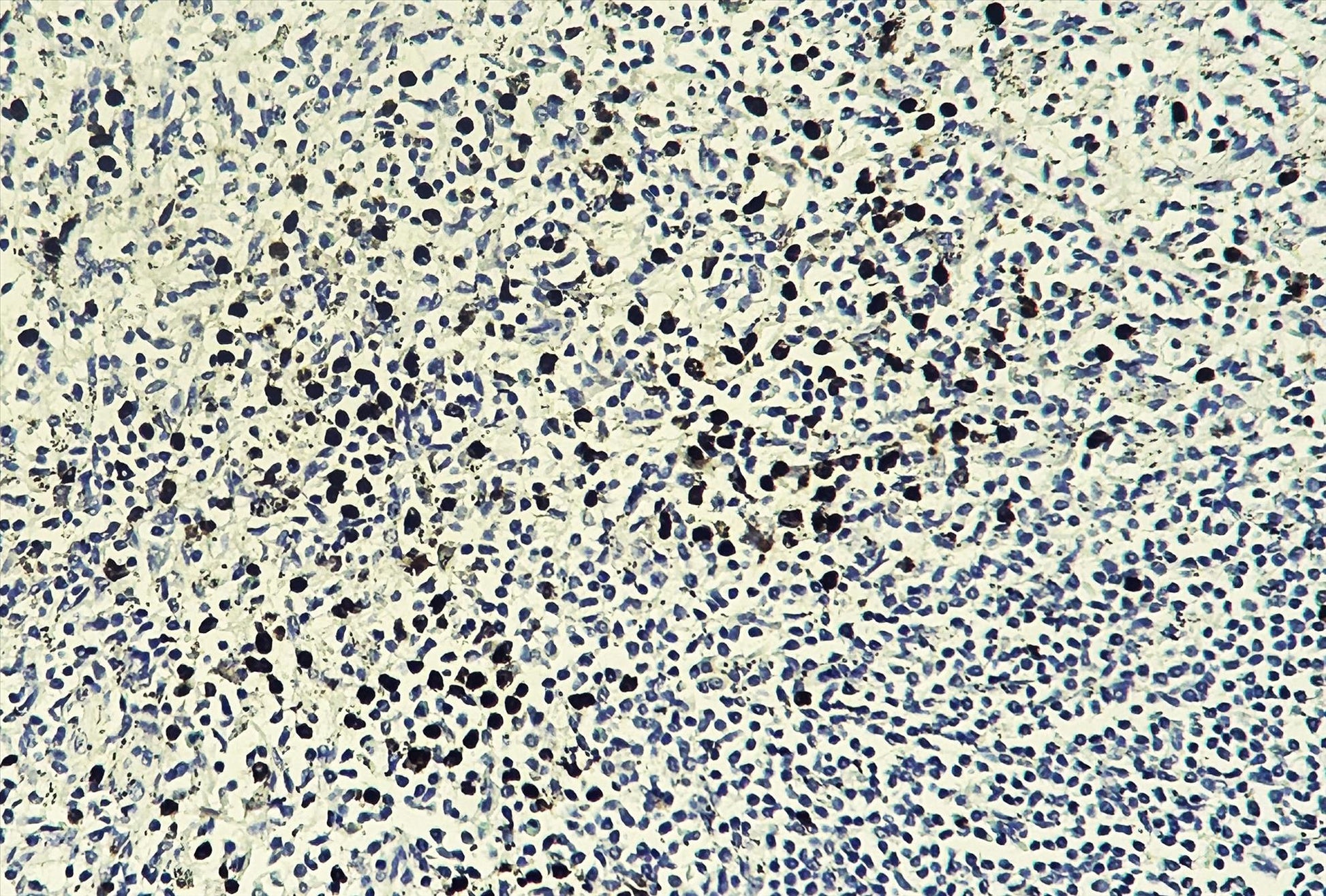 Human spleen tissue was stained with anti-Myeloperoxidase(MPO) (PT0017R) rabbit Antibody