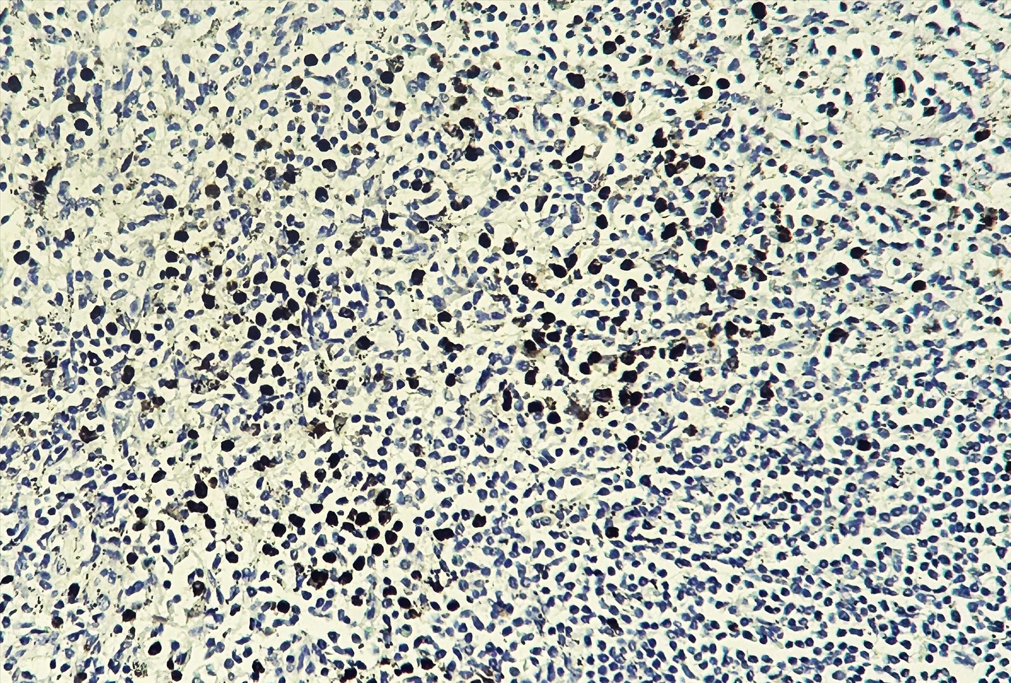 Human spleen tissue was stained with anti-Myeloperoxidase(MPO) (PT0017R) rabbit Antibody