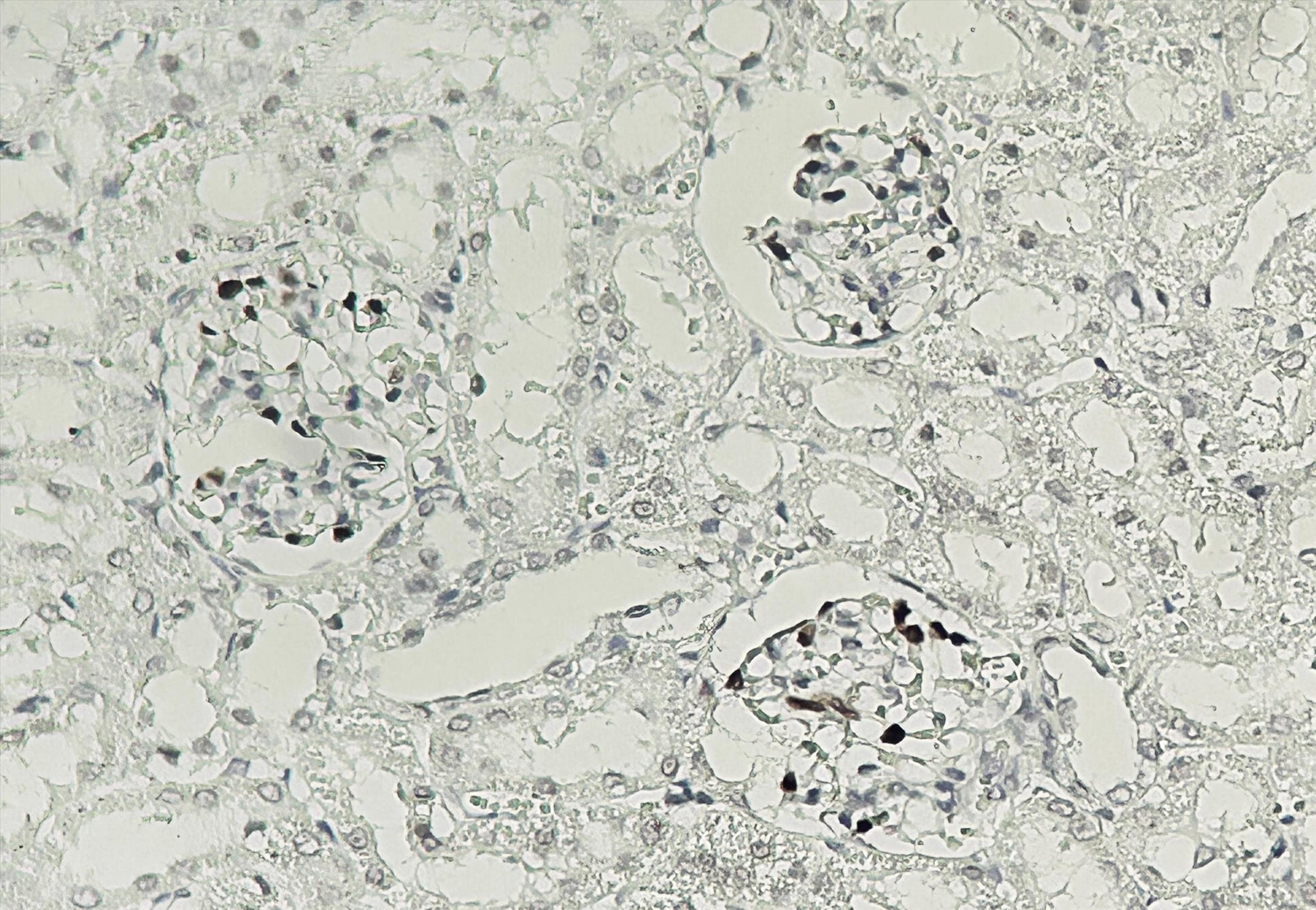 Human kidney tissue was stained with anti-p57kip2 (ABT76R) rabbit Antibody