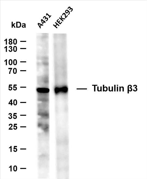 Various whole cell lysates were separated by 10% SDS-PAGE, and the membrane was blotted with anti-Tubulin Î²3 (PT0012R) antibody. The HRP-conjugated Goat anti-Rabbit IgG(H + L) antibody was used to detect the antibody.