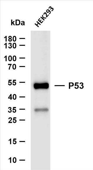 Whole cell lysates were separated by 10% SDS-PAGE, and the membrane was blotted with anti-P53 (PT0021R) antibody. The HRP-conjugated Goat anti-Rabbit IgG(H + L) antibody was used to detect the antibody.