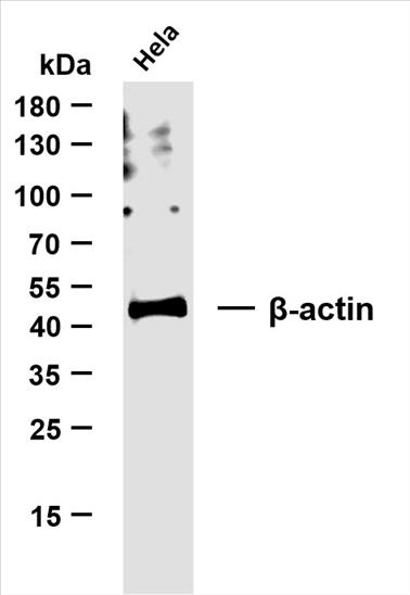 Whole cell lysates were separated by 10% SDS-PAGE, and the membrane was blotted with anti-Î²-actin(PT0022R) antibody. The HRP-conjugated Goat anti-Rabbit IgG(H + L) antibody was used to detect the antibody.