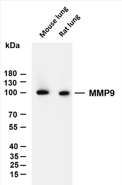 Various whole cell lysates were separated by 10% SDS-PAGE, and the membrane was blotted with anti-MMP9 (PT0044R) antibody. The HRP-conjugated Goat anti-Rabbit IgG(H + L) antibody was used to detect the antibody.