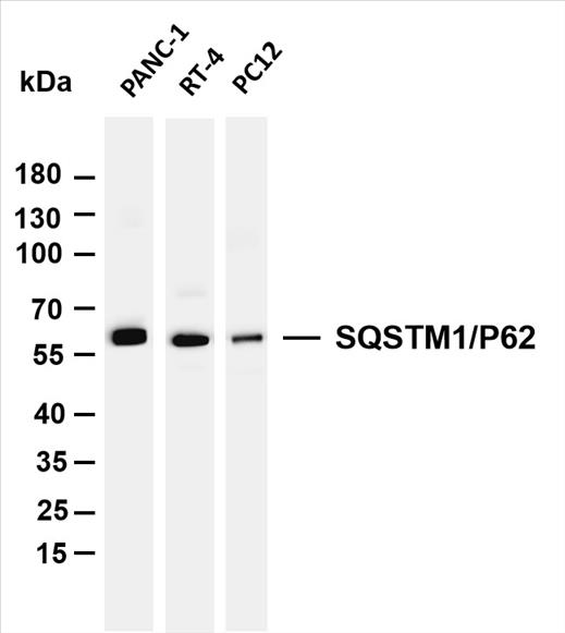 Various whole cell lysates were separated by 4-20% SDS-PAGE, and the membrane was blotted with anti-SQATM1/P62 (PT0051R) antibody. The HRP-conjugated Goat anti-Rabbit IgG(H + L) antibody was used to detect the antibody.