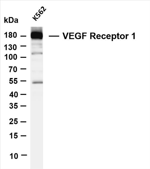 Various whole cell lysates were separated by 4-20% SDS-PAGE, and the membrane was blotted with anti-VEGF Receptor 1 (PT0056R) antibody. The HRP-conjugated Goat anti-Rabbit IgG(H + L) antibody was used to detect the antibody.