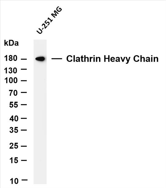 Various whole cell lysates were separated by 4-20% SDS-PAGE, and the membrane was blotted with anti-Clathrin Heavy Chain (PT0067R) antibody. The HRP-conjugated Goat anti-Rabbit IgG(H + L) antibody was used to detect the antibody.