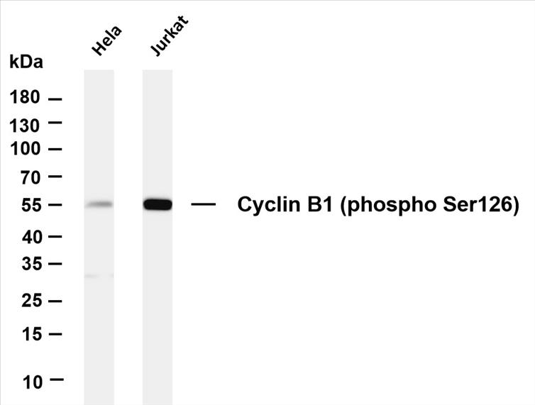 Various whole cell lysates were separated by 4-20% SDS-PAGE, and the membrane was blotted with anti-Cyclin B1 (phospho Ser126) (PT0070R) antibody. The HRP-conjugated Goat anti-Rabbit IgG(H + L) antibody was used to detect the antibody.