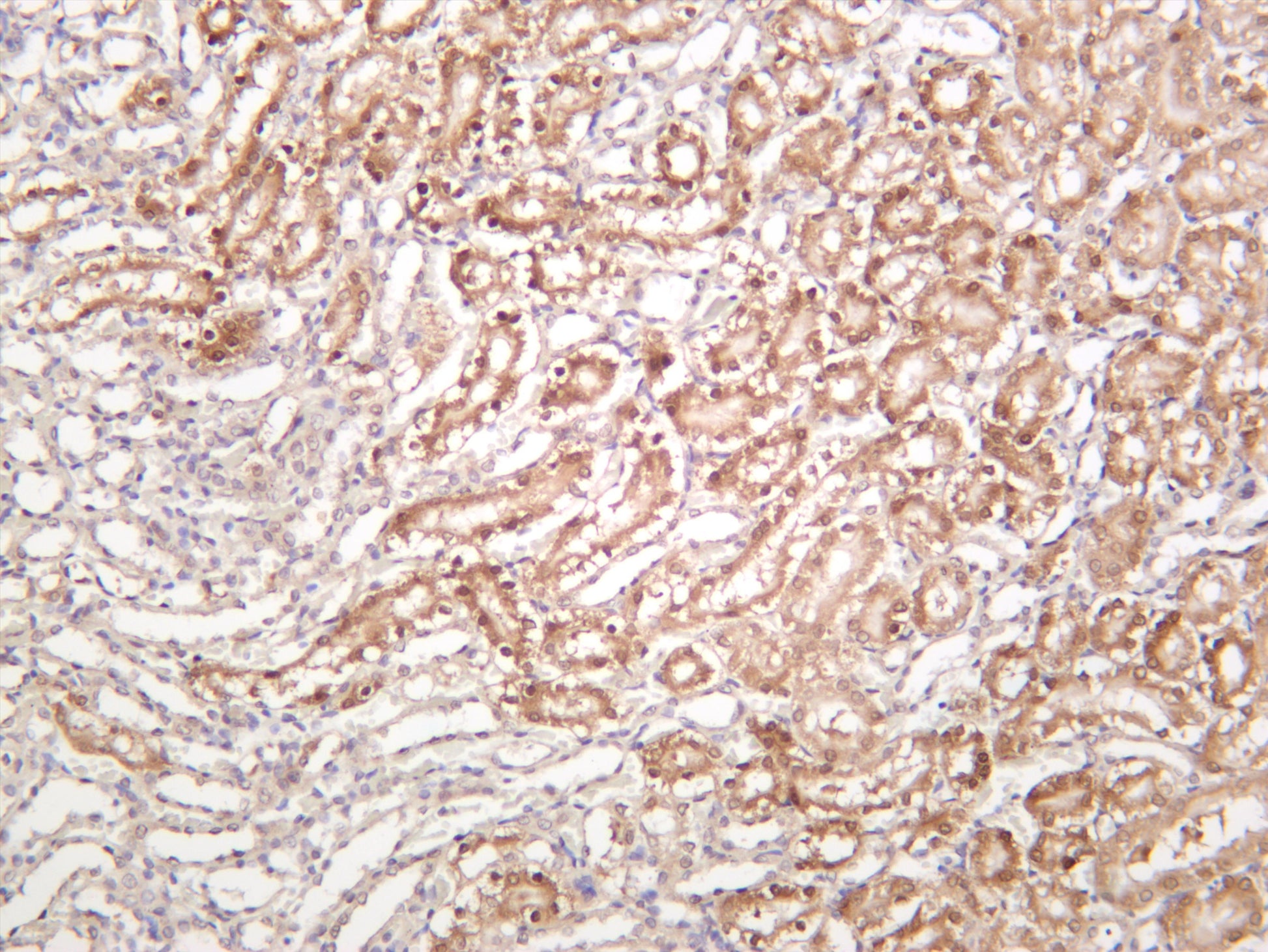 Rat kidney was stained with anti-NQO1 (PT0071R) rabbit antibody