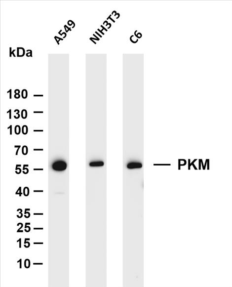 Various whole cell lysates were separated by 4-20% SDS-PAGE, and the membrane was blotted with anti-PKM (PT0080R) antibody. The HRP-conjugated Goat anti-Rabbit IgG(H + L) antibody was used to detect the antibody.