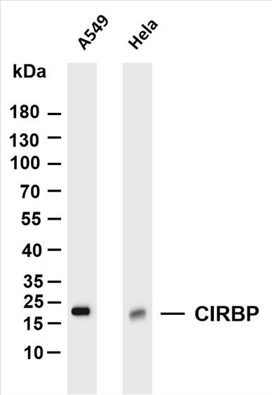 Various whole cell lysates were separated by 4-20% SDS-PAGE, and the membrane was blotted with anti-CIRBP (PT0081R) antibody. The HRP-conjugated Goat anti-Rabbit IgG(H + L) antibody was used to detect the antibody.