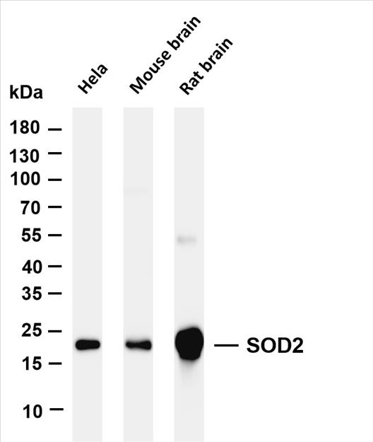 Various whole cell lysates were separated by 4-20% SDS-PAGE, and the membrane was blotted with anti-SOD2 (PT0085R) antibody. The HRP-conjugated Goat anti-Rabbit IgG(H + L) antibody was used to detect the antibody.