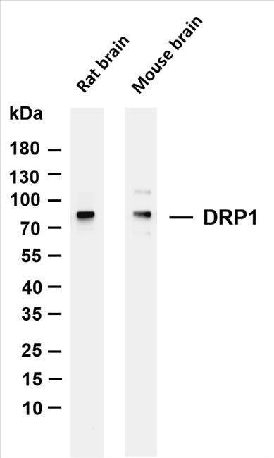 Various whole cell lysates were separated by 4-20% SDS-PAGE, and the membrane was blotted with anti-DRP1 (PT0086R) antibody. The HRP-conjugated Goat anti-Rabbit IgG(H + L) antibody was used to detect the antibody.