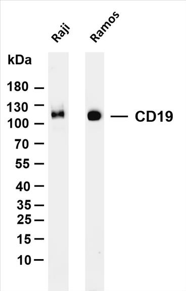 Various whole cell lysates were separated by 4-20% SDS-PAGE, and the membrane was blotted with anti-CD19 (PT0089R) antibody. The HRP-conjugated Goat anti-Rabbit IgG(H + L) antibody was used to detect the antibody.