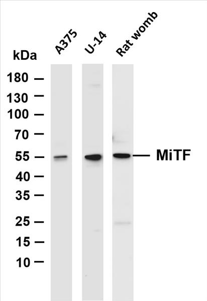Various whole cell lysates were separated by 4-20% SDS-PAGE, and the membrane was blotted with anti-MiTF (PT0106R) antibody. The HRP-conjugated Goat anti-Rabbit IgG(H + L) antibody was used to detect the antibody.
