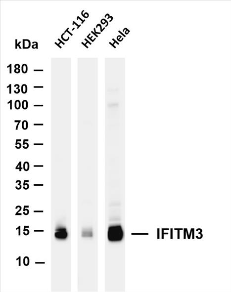 Various whole cell lysates were separated by 4-20% SDS-PAGE, and the membrane was blotted with anti-IFITM3 (PT0114R) antibody. The HRP-conjugated Goat anti-Rabbit IgG(H + L) antibody was used to detect the antibody.
