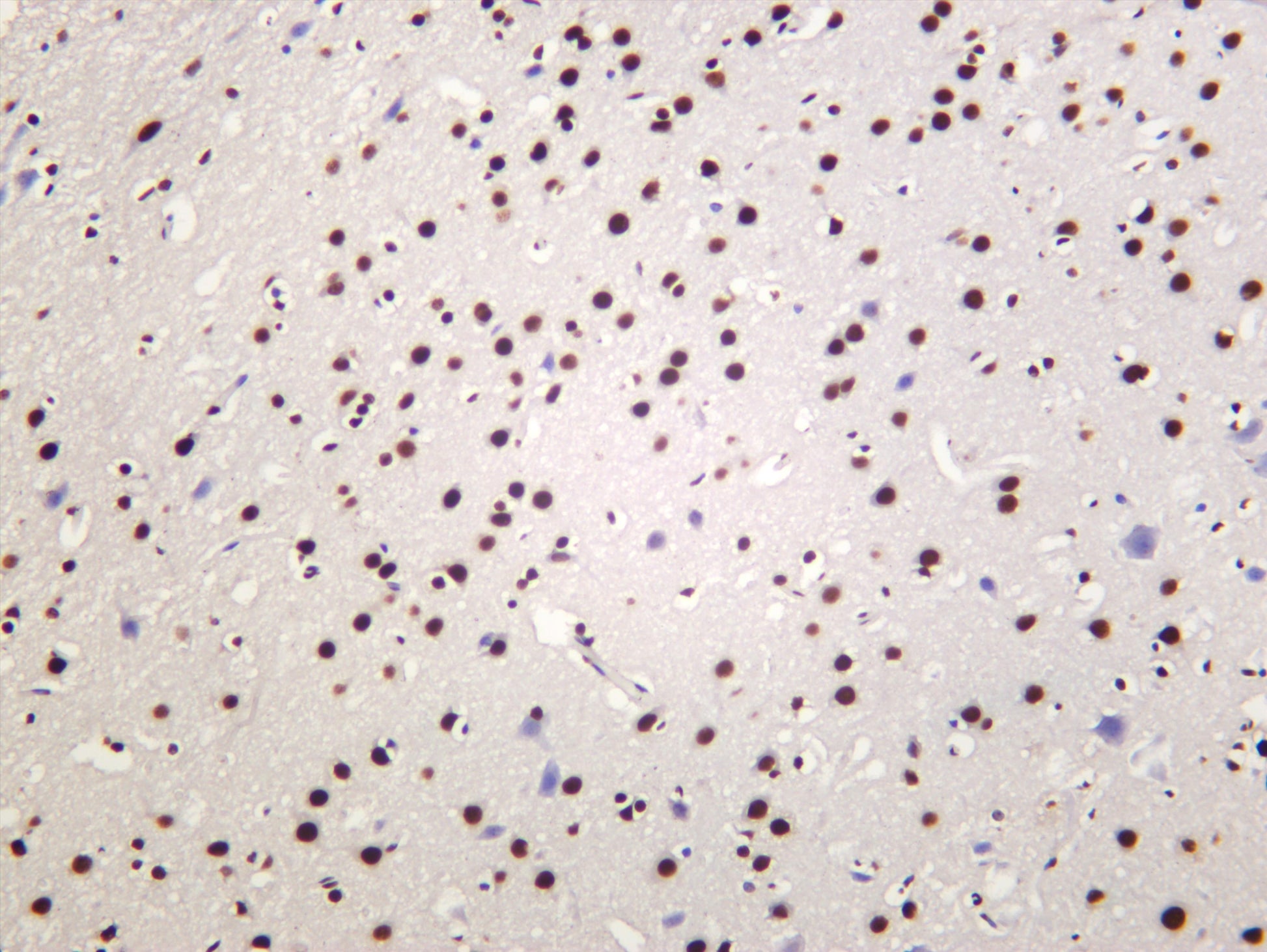 Rat brain was stained with anti-TDP43 (PT0126R) rabbit antibody
