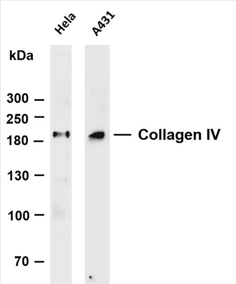 Various whole cell lysates were separated by 4-20% SDS-PAGE, and the membrane was blotted with anti-Collagen IV (PT0131R) antibody. The HRP-conjugated Goat anti-Rabbit IgG(H + L) antibody was used to detect the antibody.