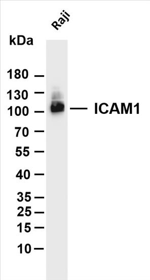 Various whole cell lysates were separated by 4-20% SDS-PAGE, and the membrane was blotted with anti-ICAM1 (PT0133R) antibody. The HRP-conjugated Goat anti-Rabbit IgG(H + L) antibody was used to detect the antibody.