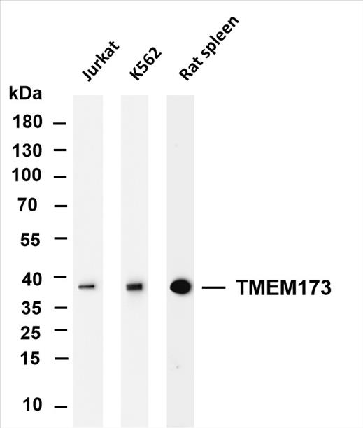 Various whole cell lysates were separated by 4-20% SDS-PAGE, and the membrane was blotted with anti-TMEM173 (PT0135R) antibody. The HRP-conjugated Goat anti-Rabbit IgG(H + L) antibody was used to detect the antibody.