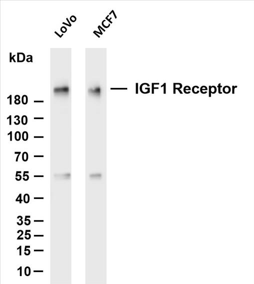 Various whole cell lysates were separated by 4-20% SDS-PAGE, and the membrane was blotted with anti-IGF1 Receptor (PT0136R) antibody. The HRP-conjugated Goat anti-Rabbit IgG(H + L) antibody was used to detect the antibody.