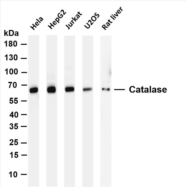 Various whole cell lysates were separated by 4-20% SDS-PAGE, and the membrane was blotted with anti-Catalase (PT0146R) antibody. The HRP-conjugated Goat anti-Rabbit IgG(H + L) antibody was used to detect the antibody.