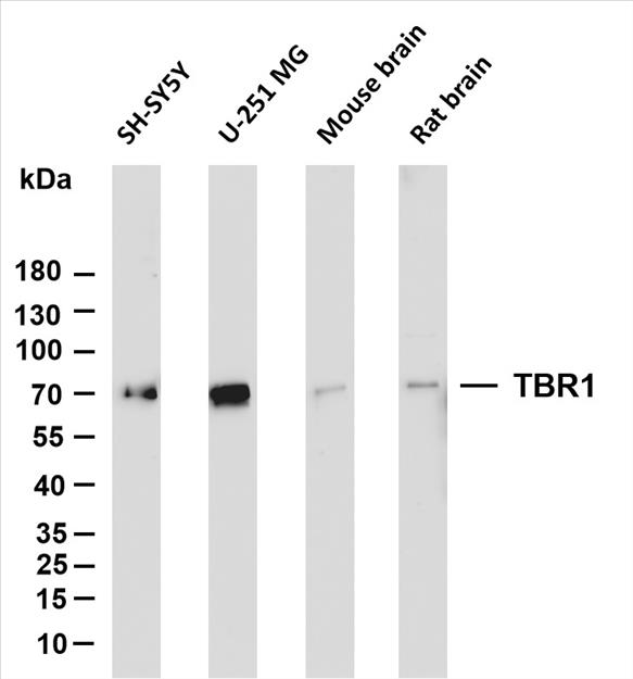 Various whole cell lysates were separated by 4-20% SDS-PAGE, and the membrane was blotted with anti-TBR1 (PT0153R) antibody. The HRP-conjugated Goat anti-Rabbit IgG(H + L) antibody was used to detect the antibody.